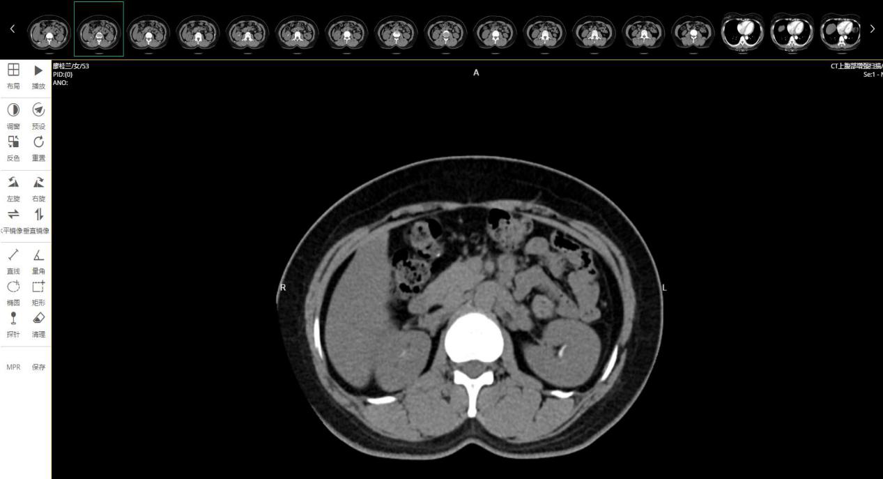 1527141219219056264.png 云图诊断DICOM界面.png