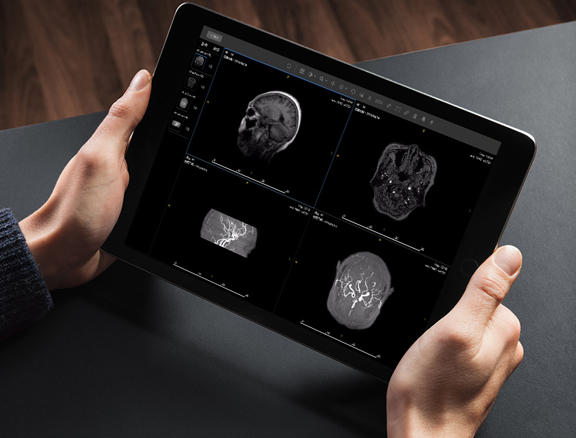 1527141099623000616.png 远程影像诊断.png