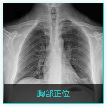 影像