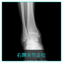 影像