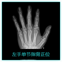 影像
