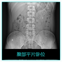 影像
